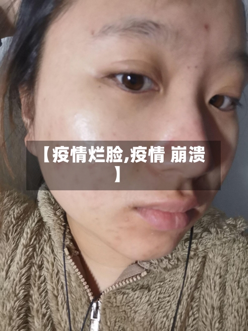 【疫情烂脸,疫情 崩溃】-第3张图片
