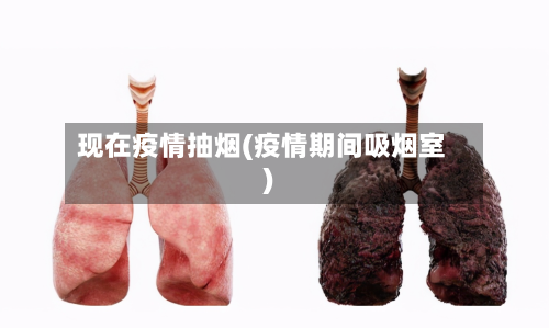 现在疫情抽烟(疫情期间吸烟室)-第2张图片