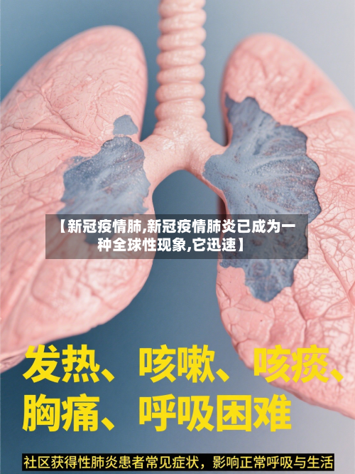 【新冠疫情肺,新冠疫情肺炎已成为一种全球性现象,它迅速】-第3张图片