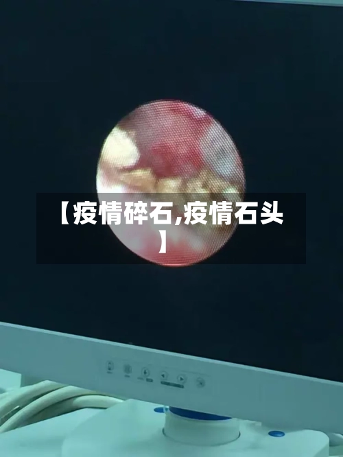 【疫情碎石,疫情石头】