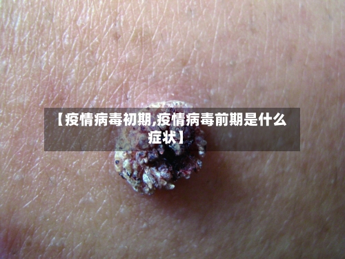 【疫情病毒初期,疫情病毒前期是什么症状】