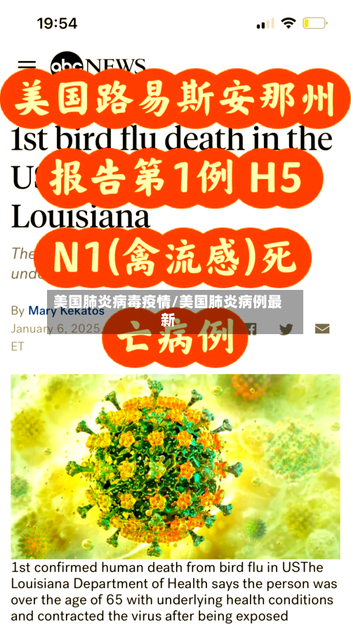 美国肺炎病毒疫情/美国肺炎病例最新