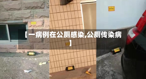 【一病例在公厕感染,公厕传染病】