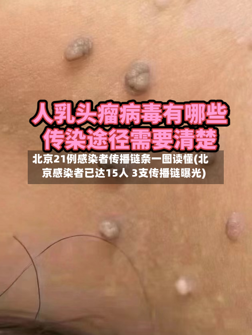 北京21例感染者传播链条一图读懂(北京感染者已达15人 3支传播链曝光)
